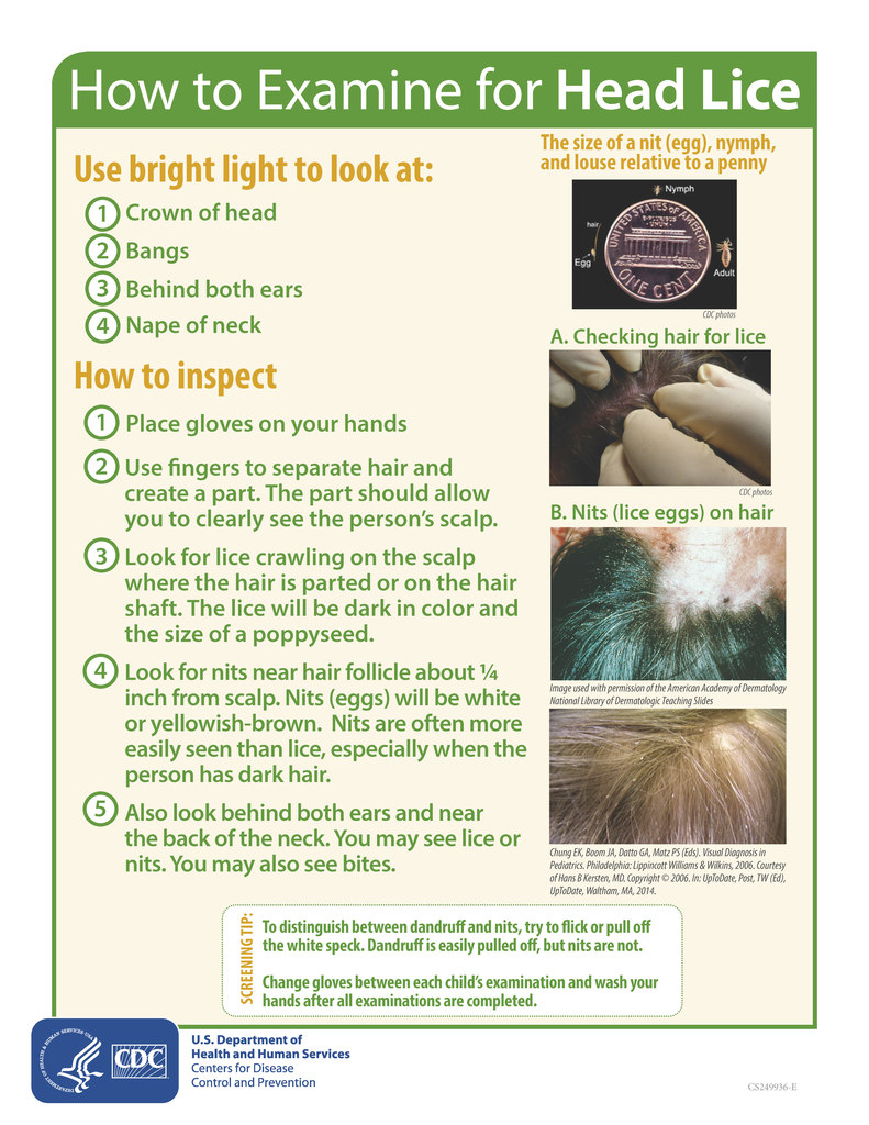 CDC head lice flyer. green header and text, beige background